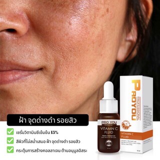 PROYOU VITAMIN C FLUID 15 ML.เซรั่มวิตามินซีบริสุทธิ์เข้มข้น ลดรอยดำ ฝ้า กระ ปรับผิวกระจ่างใสไม่หมองคล้ำ แพ้ง่ายใช้ได้