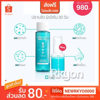 Niki Toner Niki Anti Acne Essence โทนเนอร์​ญี่ปุ่น กระชับรูขุมขน โทนเนอร์นิกิ เช็ดสิวเสี้ยน โทนเนอร์ niki โทนเนอร์ นิกิ