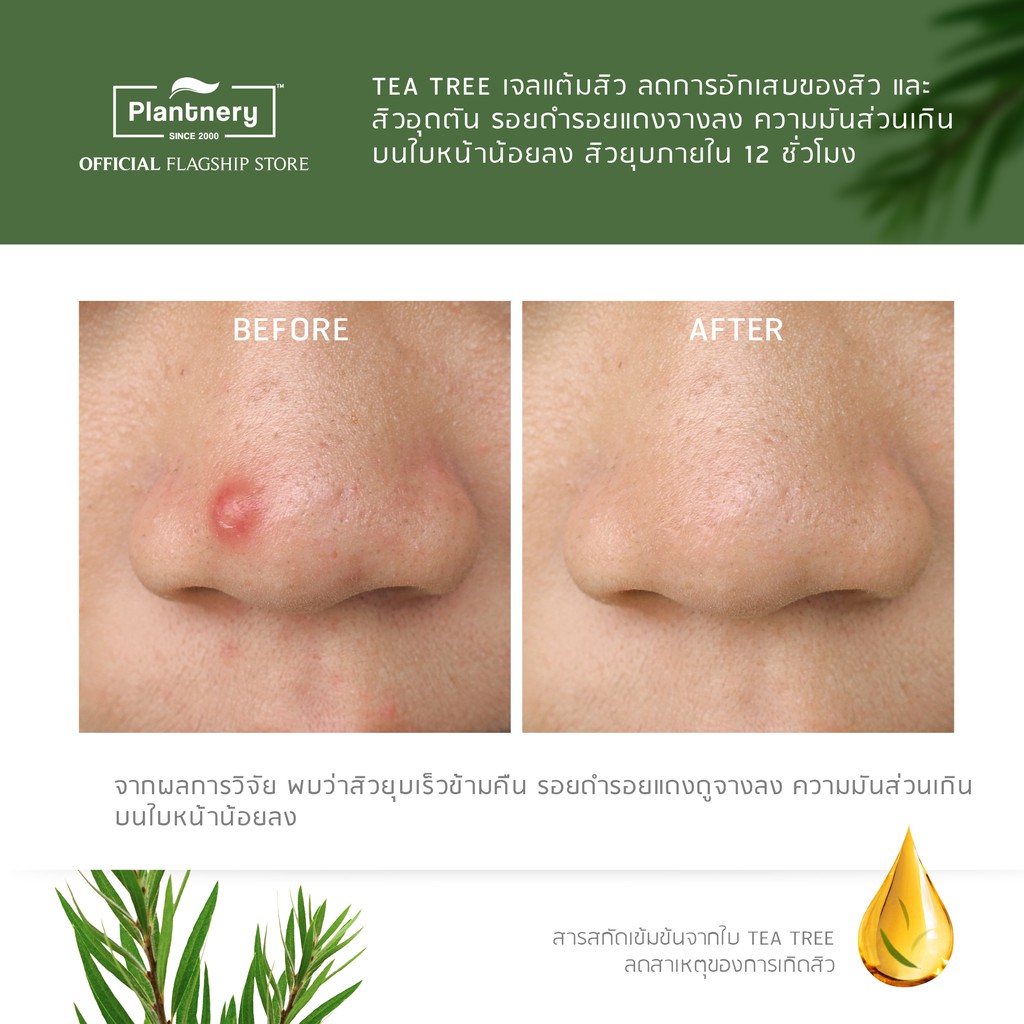 Plantnery Tea Tree Intense Acne Gel 15 g เจลแต้มสิว ที ทรี สูตรเข้มข้น #6