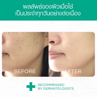 [แพ็ค 3] Smooth E Face Lift External Capsules 12 'S แคปซูล From USA ยกกระชับผิวหน้าและลำคอ กระชับรูขุมขน บรรจุ 12 สมูทอี