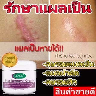 เห็นผล100% ครีมทารอยแผลเป็น  สิว รอยแตกผิว 50g ยาทาแผลเป็น ครีมลดแผลเป็น เจลทาแผลผ่าตัด ลบรอยแผลผ่าตัด