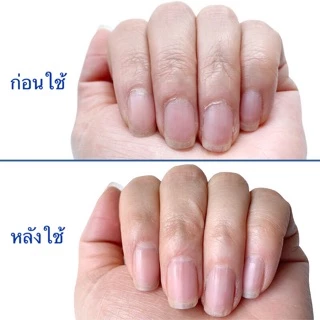 ✅BlueCross น้ำยาหนังนิ่ม ของแท้จากอเมริกา มีอย. Cuticle Remover | Made in USA 🔥 น้ำยาตัดหนัง