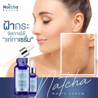 เซรั่มณัชชา 💕สิวหาย ฝ้าจาง ในราคาหลักร้อยต้น ๆ✨💖 ด้วยเซรั่มณัชชา (Natcha Serum) ปริมาณ 30 มล.