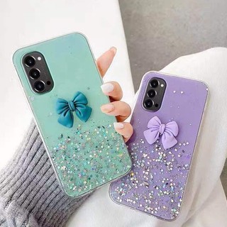 เคส-OPPO Reno 8T A78 A98 A17K A77 A57 A96 Reno 8Z 7Z A96 A76 A95 A16 Reno 6Z A54 A74 A15