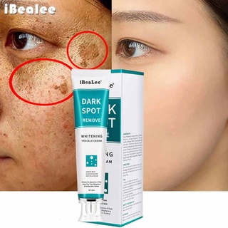 Effective Whitening Freckle Cream Remove Melasma Acne Dark Spot Melanin Moisturizing Skin Care 20ml