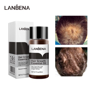 LANBENA แฮร์โทนิค เอสเซ้นส์การเจริญเติบโตของเส้นผม ทรีทเม้นต…