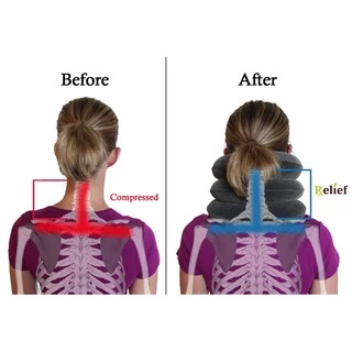 เครื่องล็อคคอ ที่ดึงคอยืดกระดุกคอ Neck Massage neck traction เพื่อบำบัดอาการปวดต้นคอ A88