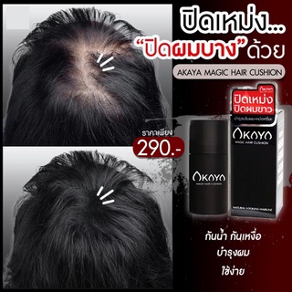 ♦️ของแท้·พร้อมส่ง♦️ AKAYA HAIR CUSHION คูชั่น คุชชั่นปิดเหม่ง ปิดผมบาง หัวล้าน ผมบาง ผงไฟเบอร์เพิ่มผมหนา จัดเเต่งทรงผม