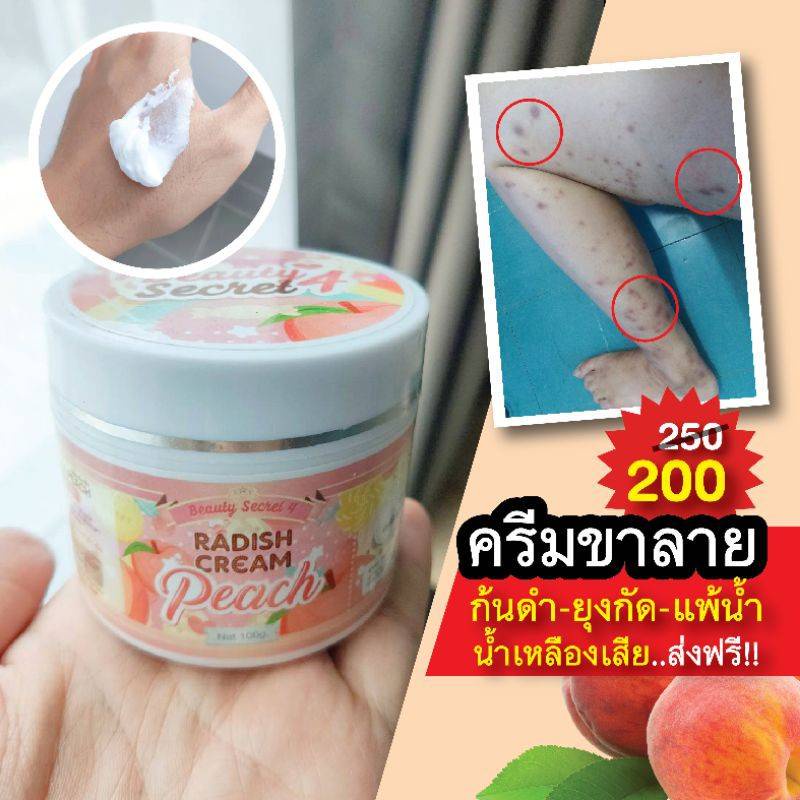 ครีมพีช ทาก้นลาย ขาลาย น้ำเหลืองไม่ดี RADISH CREAM PEACH ขนาด 200 กรัม