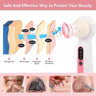 Visible Blackhead remover เครื่องดูดสิว ดูดสิวเสี้ยนอุตตันไฟฟ้า