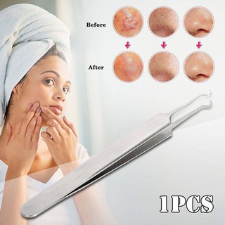 Trim acne tweezers Stainless ที่กดดึงสิวสแตนเลส อุปกรณ์ดึงสิวเสี้ยน