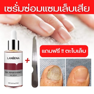 💥เซรั่มบำรุงเล็บ LANBENA ดูแลเล็บ บำรุงเล็บ รักษา ป้องกัน เชื้อรา แก้ไขปัญหาเล็บต่างๆ 15ml. ของแท้ 100%