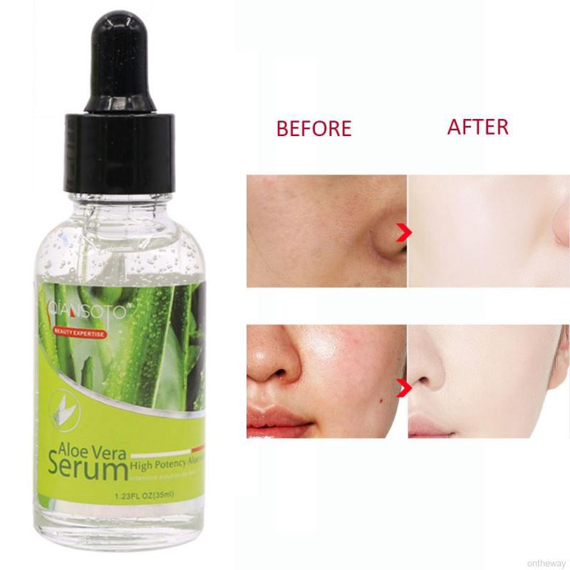 aloe vera serum for face