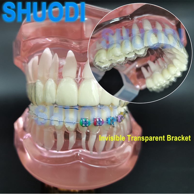 Dental Tooth Model with Invisible Transparent Bracket Orthodontic Model for Patient Communication De
