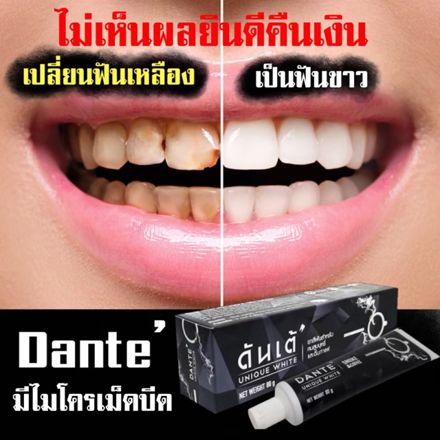 🇺🇸DANTE’ดันเต้🇺🇸 ยาสีฟันนวัตกรรมใหม่ ช่วยให้ฟันขาวขึ้น ลดคราบเหลือง บุหรี่ ชา กาแฟ