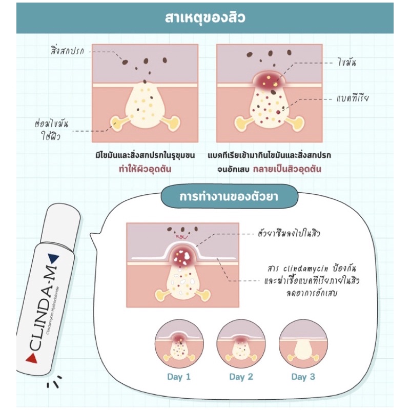 Clinda-M(แต้มสิวอักเสบ) - idin_office - ThaiPick