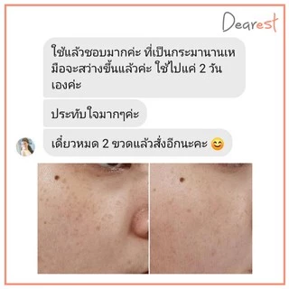 Dearest 2in1 mask&clean เจลล้างหน้าสูตรเซรั่ม เดียร์เรส 100 ml