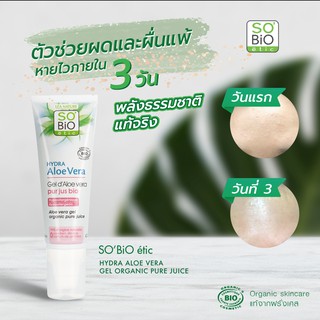 SOBIO ETIC - HYDRA ALOE VERA GEL ORGANIC PURE JUICE 125 ml เจลว่านหางจระเข้ออแกนิค ลดผดผื่น สิวผด