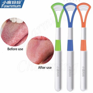 (ชุดละ 2 อัน) ที่ขูดลิ้น แปรงขูดลิ้น ที่กวาดลิ้น ทำความสะอาดลิ้น Tongue cleaner  อุปกรณ์ดูแลช่องปาก