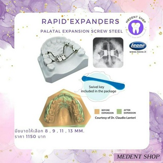 [ ยี่ห้อ Leone ] Rapid expanders Palatal expansion screw steel