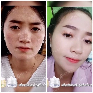 ครีมรกพืชsm ของแท้บริษัท100%[ขายแยก-ยกชุด]10g-15g smskincare