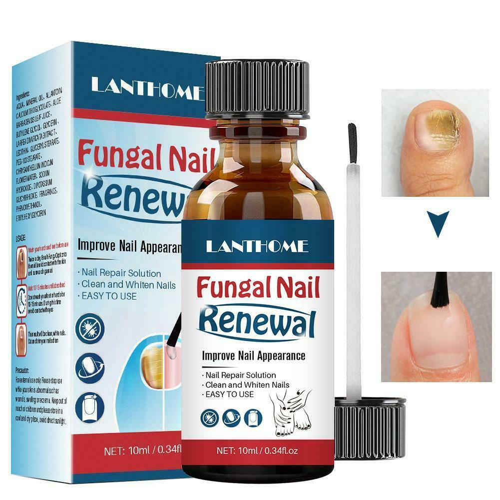 LANTHOME 10ml fungal nail repair nourish fungal nail to anti-infection hand treatment foot G9O6