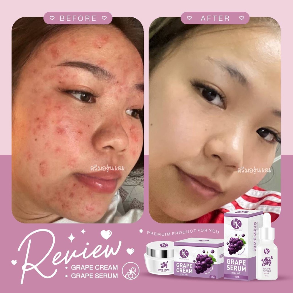 เซรั่มองุ่นมินิ ลดริ้วรอย หน้าหมองคล้ำ ขนาดพกแพ้ แท้ 100% - รูปที่ 4