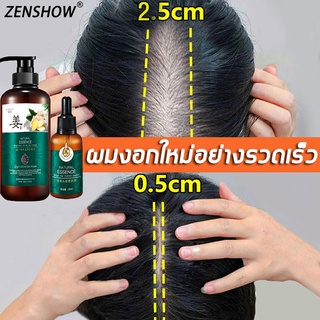 ของแท้100%ZENSHOW แชมพูขิง,แชมพูแก้ผมร่วง(แชมพูขิงเพียว แชมพูขิงชุดรวม แชมพูขิง บำรุงหนังศรีษะ แชมพูปลูกผม สระผมแก้ร่วง)