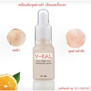 V-KAL วีแคล ช่วย ลดฝ้า และ จุดด่างดำให้จางลง ปริมาณ 10 ml