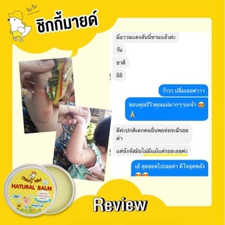 [โปร 2 ชิ้น] บาล์มลดคัน ลดบวม ไม่ทิ้งรอยดำ Chicky Mild บาล์มทายุงกัด มด แมลง ผื่นแพ้ ทาหน้าได้
