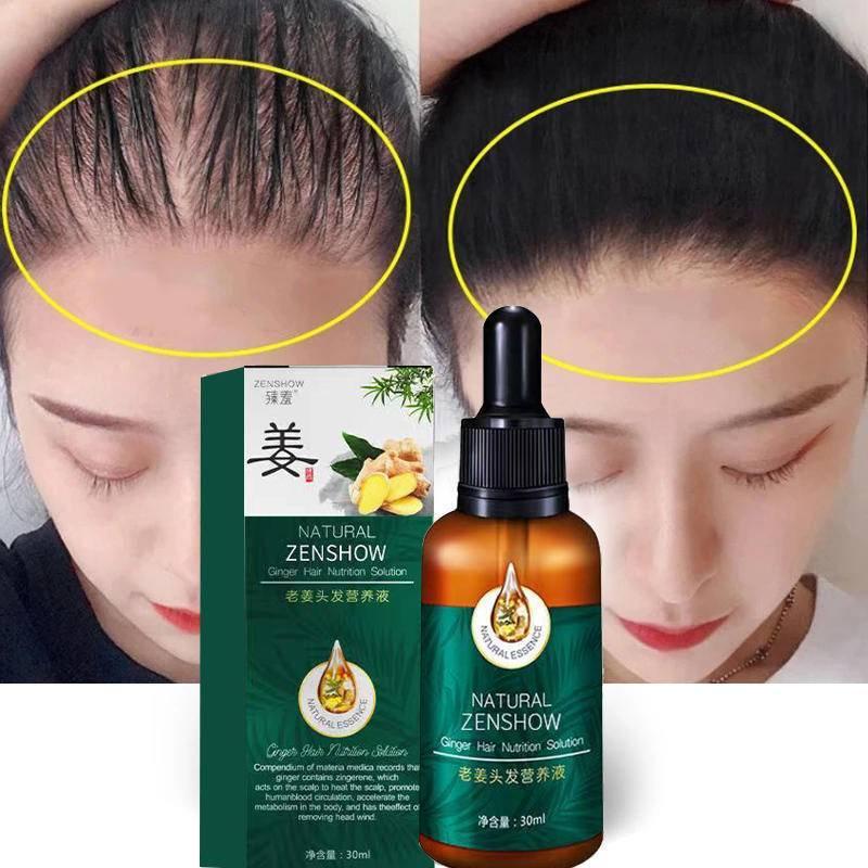 Ginger Hair Treatment Essential Oil Essence Original Genuine 100% Hair Loss  Liquid Health and Beauty Thick Hair Growth Essence 30ml | Shopee Thailand