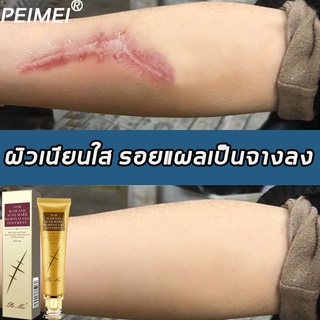 PEIMEI ครีมลดรอยแผลเป็นบางเบา 30g ทำให้เนื้อเยื่อแผลเป็นนุ่มขึ（เจลลดรอยแผลเป็น ครีมกำจัดรอยแผลเป็น  ） Light scar cream