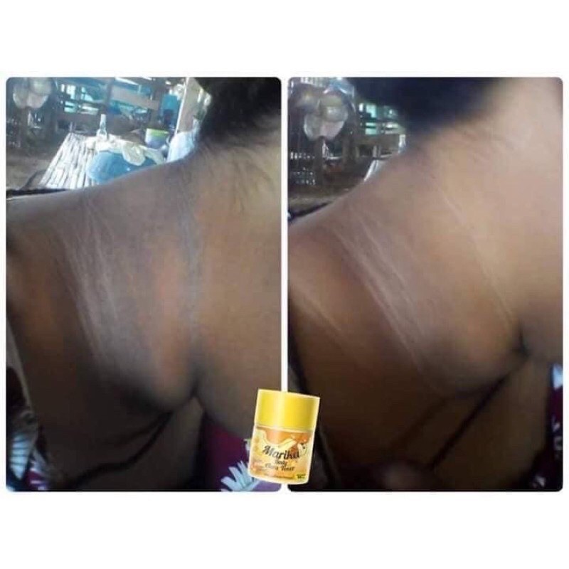 โทนเนอร์มาริกาเช็ดคอดำ ขาหนีบดำ รักแร้ดำ ข้อศอกดำ - รูปที่ 4