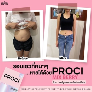 BFB Double S Proci สมุนไพรหุ่นเพรียว