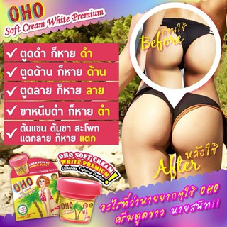 OHO soft cream white premium ครีมแก้ก้นดำ ก้นด้าน ก้นแตกลาย ขาหนีบดำ ข้อศอก หัวเข่า ตาตุ่ม ดำด้าน ส้นเท้าแตก