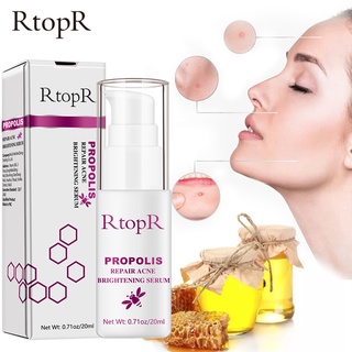 [คลังสินค้าใส]Peach Beauty Rtopr Propolis เซรั่มบํารุงผิวหน้า ลดสิว 20 มล