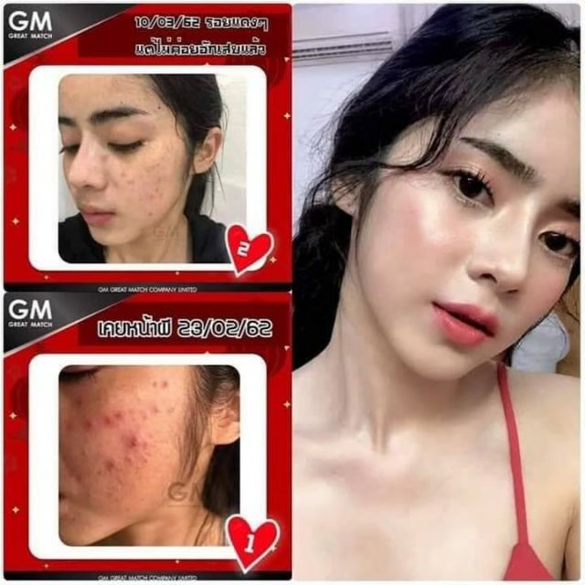 ไซโกะโนะ Saikono Collagen