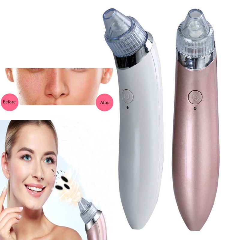 ** Goodsky เครื่องดูดสิวเสี้ยน สิวหัวดำให้ออกได้อย่างง่ายดาย กำจัดสิ่งสกปรกบนใบหน้าได้อย่างล้ำลึก กระชับรูขุมขน