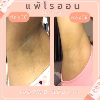 พร้อมส่ง ✨PWB ของแท้ 100%💕new packe💕ครีมบำรุงผิว ลดรอยแตกลาย รอยดำ รอยสิว รอยแผล มีบัตรตัวแทน