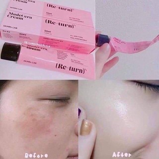 MadeCara Cream Skinrx Lab Madecera Re-turn Cream  ฝ้า กระ รอยดำ รอยแดง รักษาไม่หายใช้เถอะ หน้าใสมาก*ของแท้ พร้อมส่ง