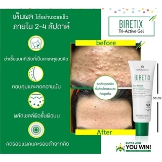 ส่งฟรี BIRETIX Duo / BIRETIX Cleanser / BIRETIX Tri Active / BIRETIX Mask / Oral เวชสำอางรักษาสิว triactive