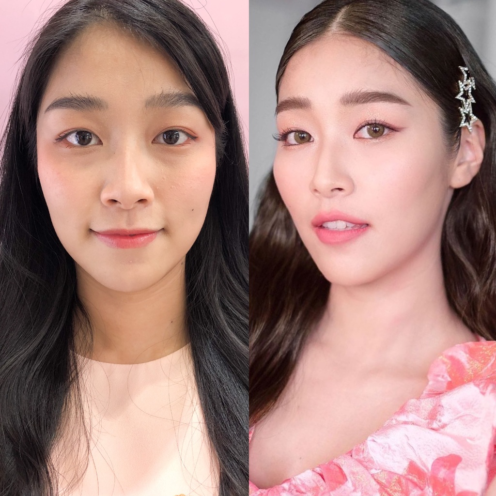 Botox (Nabota) 100 U or Jawline + Face Lift 100 ยู หรือ กราม+ลิฟท์หน้า โบท็อกเกาหลียี้ห้อเดียวที่ได้ US FDA