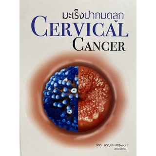 9786164682894 มะเร็งปากมดลูก (CERVICAL CANCER)