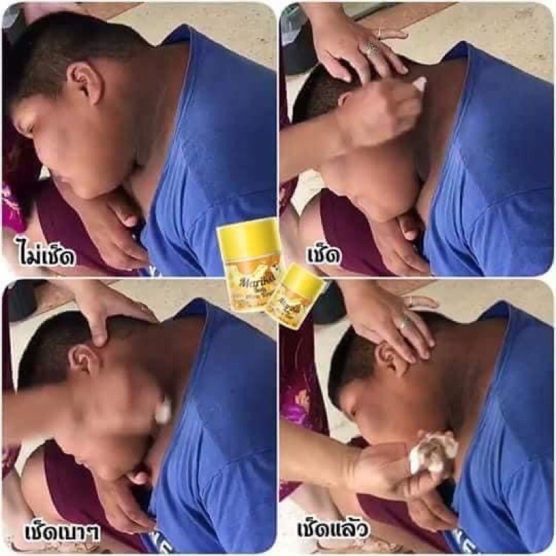 โทนเนอร์มาริกาเช็ดคอดำ ขาหนีบดำ รักแร้ดำ ข้อศอกดำ - รูปที่ 3