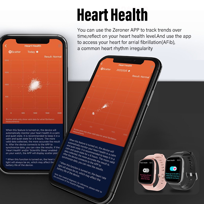 â§âœšâ™›2022 New Smart Watch Women 5ATM Waterproof AFib Heart Rate