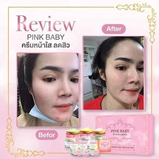 [ลดทันที 50฿ โค้ดDETSEP199] Pink Baby Cream ครีมพิ้งค์เบบี้ แบบชุด แบบแยก