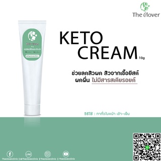 KETO CREAM ช่วยลดสิวผด ผดผื่น แพ้ง่าย