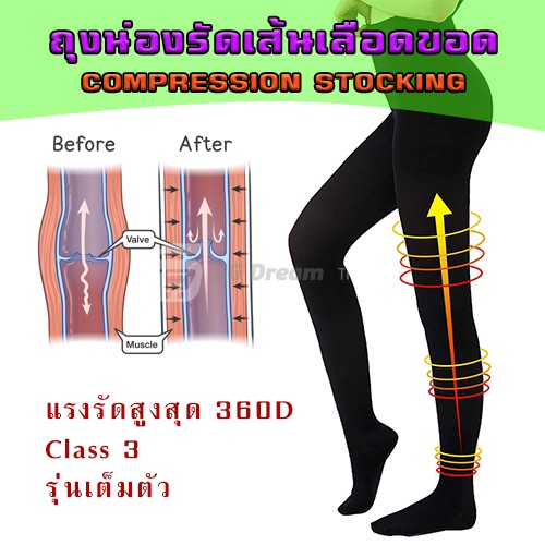 134-ถุงน่องป้องกันเส้นเลือดขอด ถุงน่องรัดขา Class 3 (34-46 mmHg) รุ่นเต็มตัว