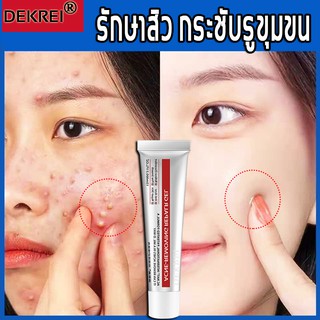 DEKREI ครีมแต้มสิว 15ml รักษาสิว กระชับรูขุมขน(ครีมลดสิว ครีมแต้มสิวเจลแต้มสิว ครีมกำจัดสิว ครีมบำรุงหน้าเจลรักษาสิว)