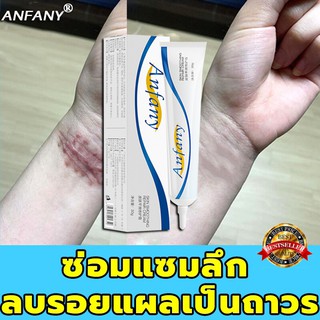 ANFANY ครีมลดรอยแผลเป็น ครีมลบแผลเป็น ครีมลบรอยแผลเป็น เจลลบรอยแผลเป็น ลดและซ่อมแซมแผลผ่าตัด ซ่อมแซมรอยแผลต่างๆ(30g)